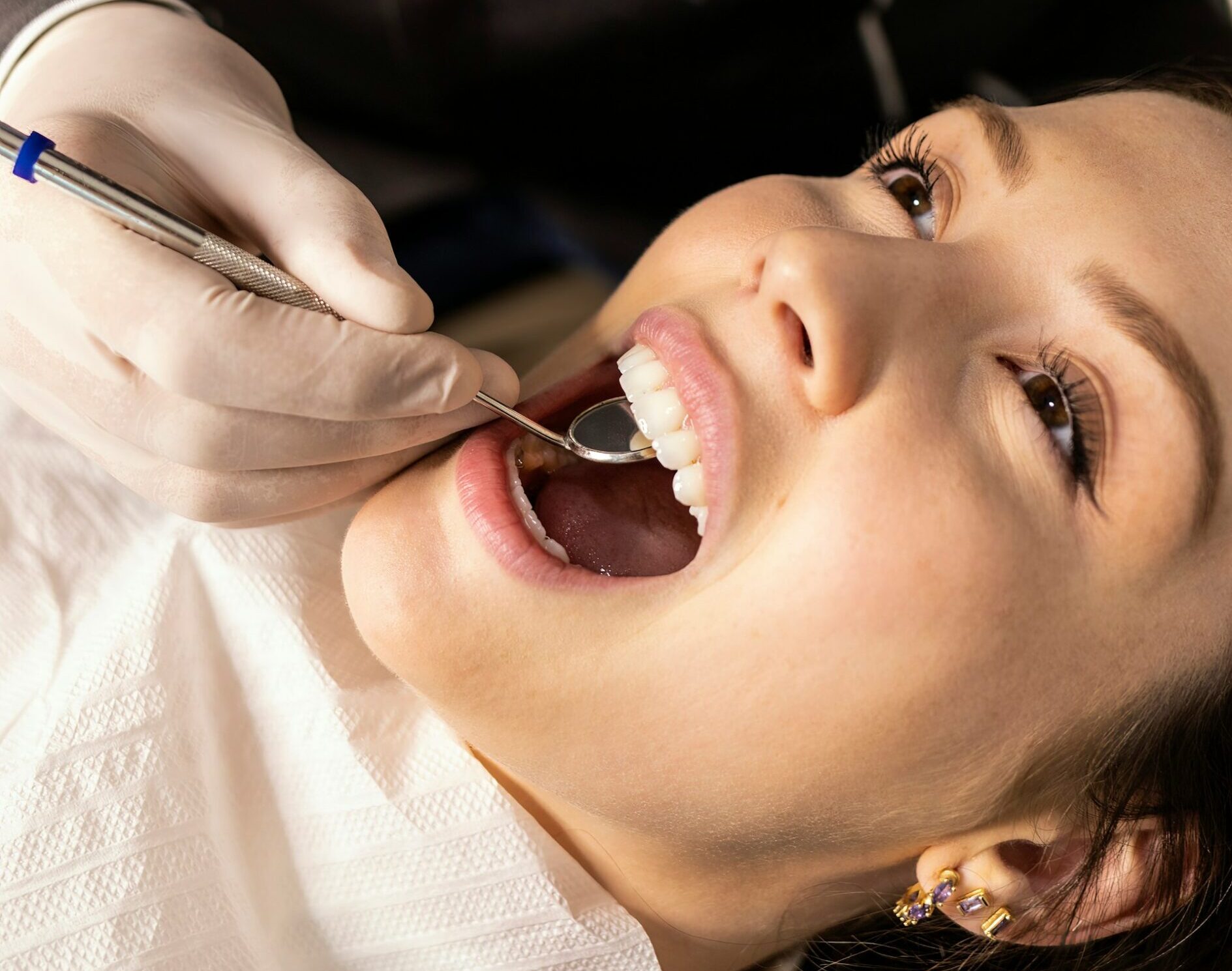 Τι είναι η ουλίτιδα και πώς θα καταλάβω αν έχω;